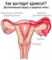 Воспалительный процесс