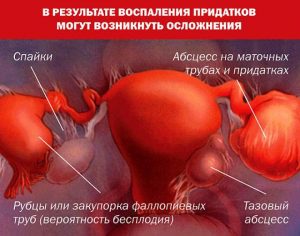 Осложнения болезни