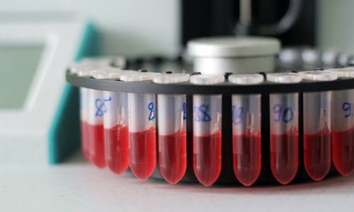 Диагностика цитомегаловирусной инфекции