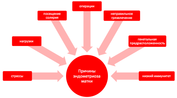 Причины эндометриоза матки