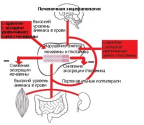 Печеночная энцефалопатия