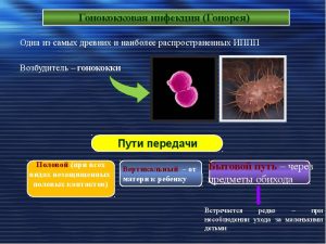 Гонококковая инфекция