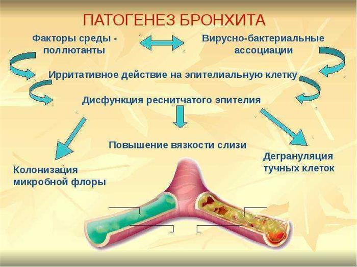 Патогенез бронхита