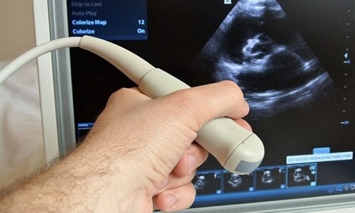 УЗИ органов мочеполовой системы проводится при подозрении на осложнения, вызванные циститом