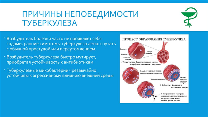 Симптомы и лечение туберкулеза