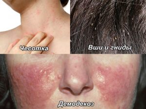 Показания к применению