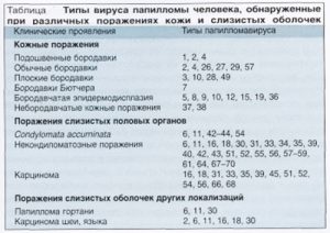 Штаммы папилломавируса человека