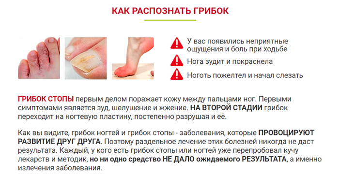 Как распознать грибок