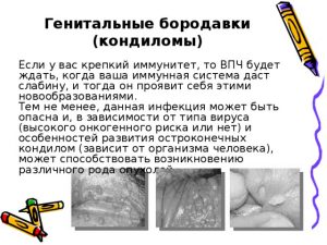 Особенности генитальных кондилом
