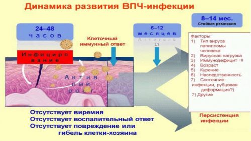 Динамика развития ВПЧ-инфекции