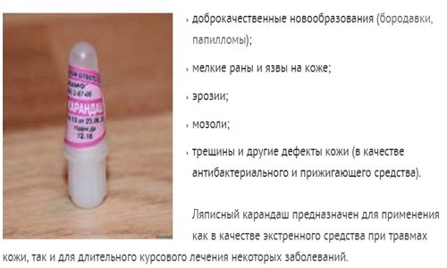 Показания к применению