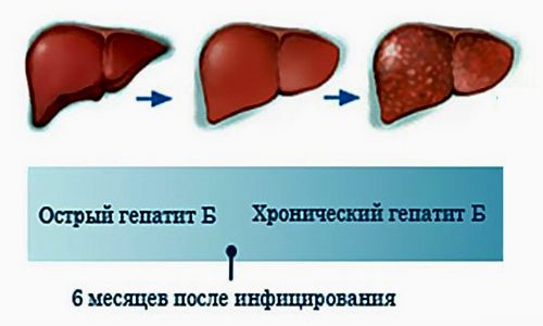 Острый и хронический гепатит В