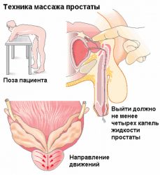 Техника массажа