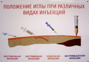 Положение иглы