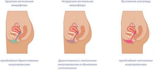 Вагинальная микрофлора