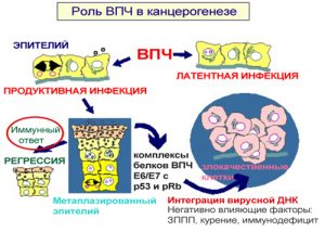 Роль ВПЧ в канцерогенезе