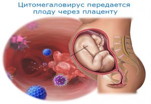 Заражение при беременности