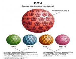 Некоторые типы ВПЧ
