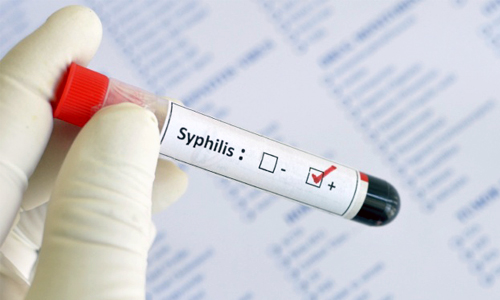 Анализ на сифилис