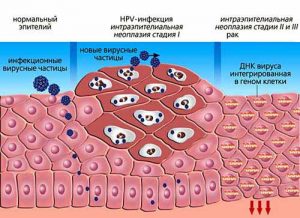 Вирусные частицы ВПЧ