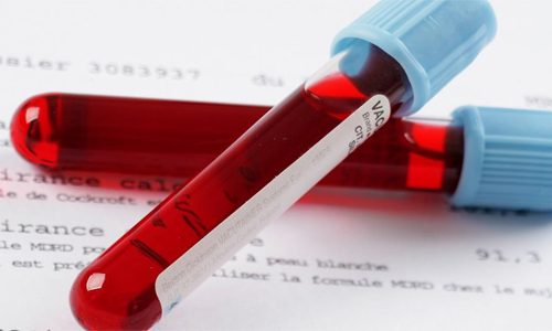 Исследование крови на ВПЧ