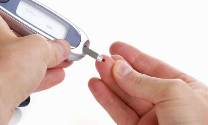 Сахарный диабет - причина возникновения кандидозного цистита