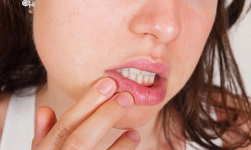 Проблема сифилиса губ