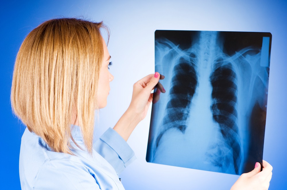Симптомы и лечение туберкулеза