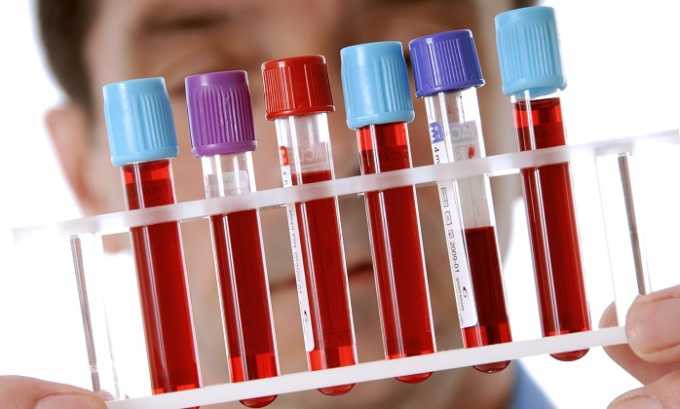 Общий анализ крови используется для определения степени воспалительного процесса в организме