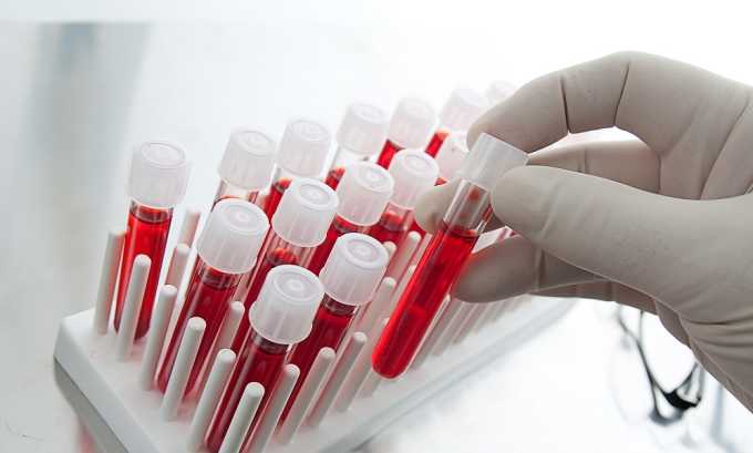 Анализы крови позволяют выявить патологический процесс в организме, т.к. количество эритроцитов в образцах будет повышенным