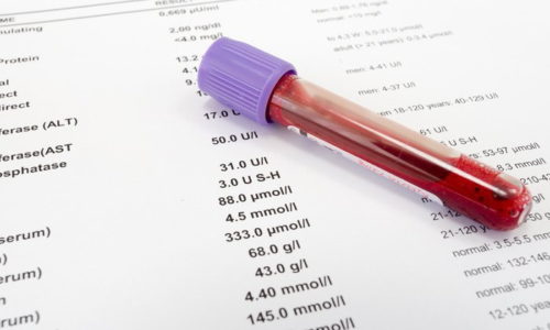 Биохимический анализ крови - метод лабораторного исследования, с помощью которого выявляется концентрация химических веществ и биологически активных элементов в сыворотке крови больного