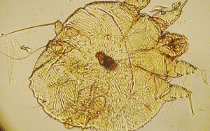 Чесоточный клещ под микроскопом