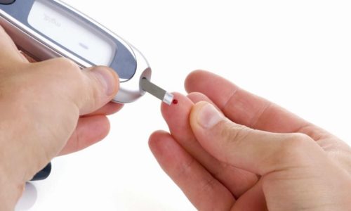 При диабете наблюдается повышенное выделение урины (до 15 л в сутки) и увеличение частоты суточных мочеиспусканий до 50