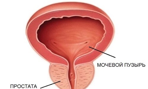 Очаги воспаления при цистите диагностируют в любых органах, в том числе и в мочевом пузыре