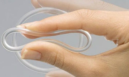 Маточные кольца при выпадении матки