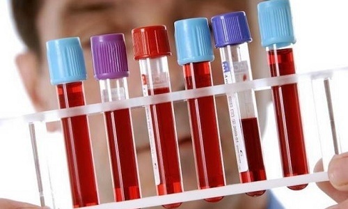 Для уточнения диагноза специалист назначает человеку сдать кровь на анализ