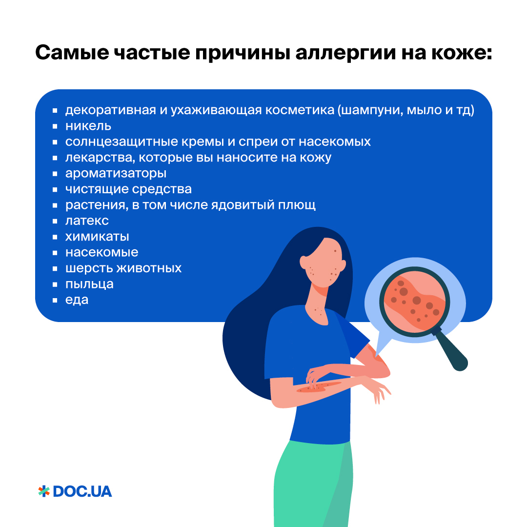 Аллергия: причины и методы лечения