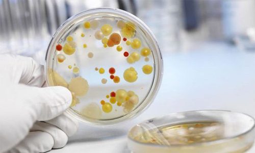 Бак посев уреаплазмы с расшифровкой и устойчивостью к антибиотикам