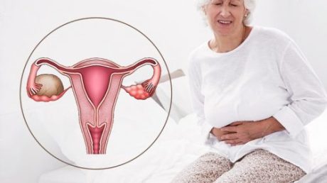 Чем опасна киста яичника у женщины в период менопаузы?