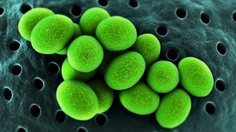 Что такое и как проявляется Ureaplasma urealyticum