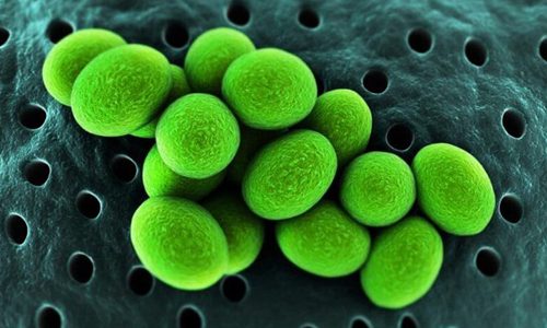 Что такое и как проявляется Ureaplasma urealyticum