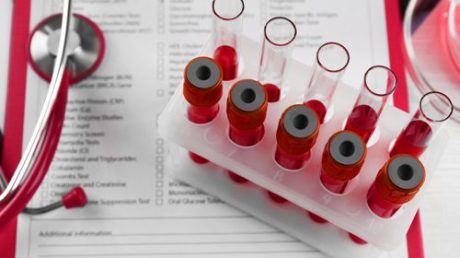 Что значит положительный анализ на Анти HCV?