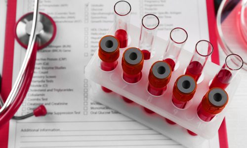 Что значит положительный анализ на Анти HCV?