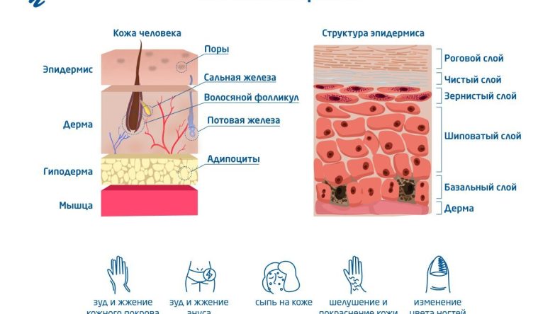 Дерматомикозы: Исцеление домашними методами и прочие советы народной терапии
