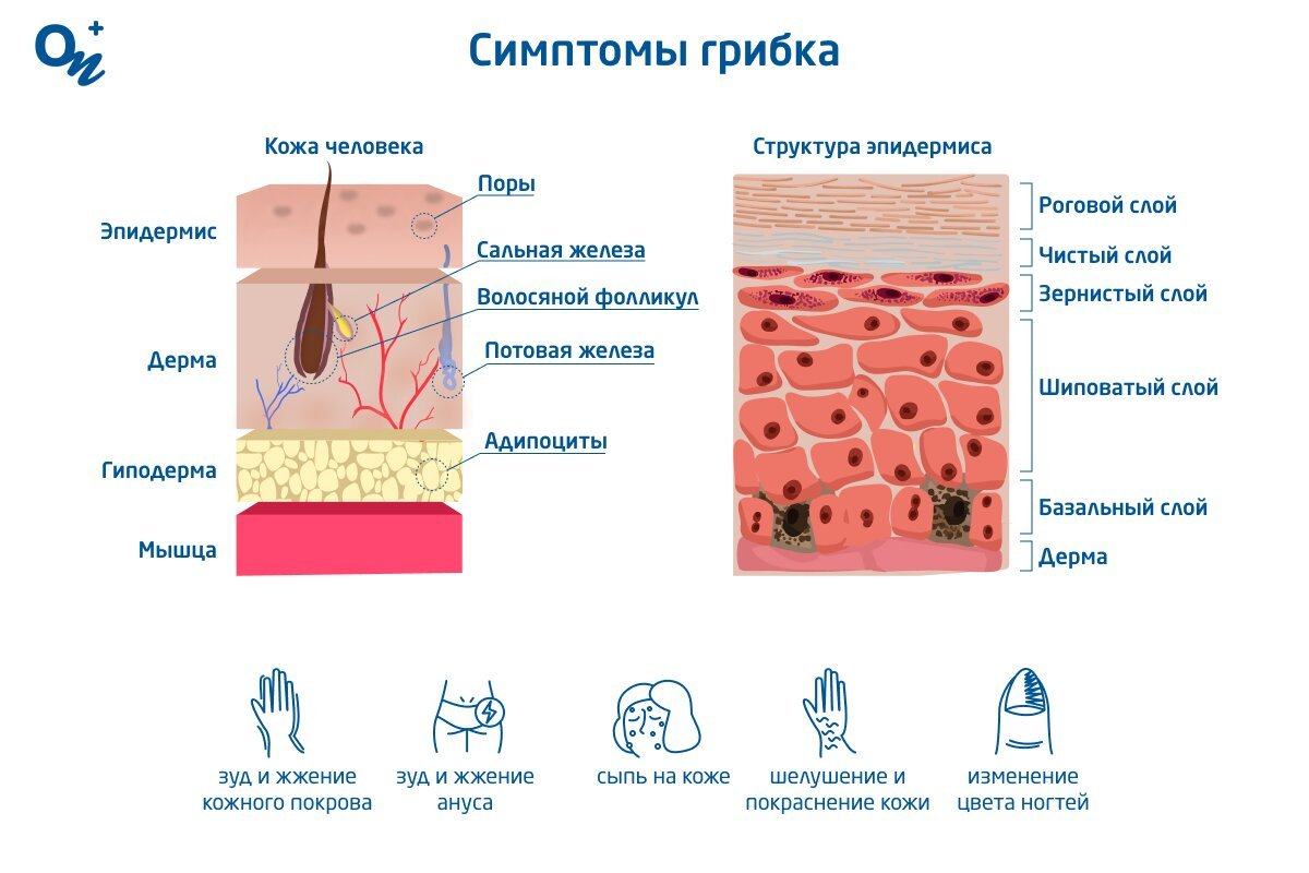 Дерматомикозы: Исцеление домашними методами и прочие советы народной терапии