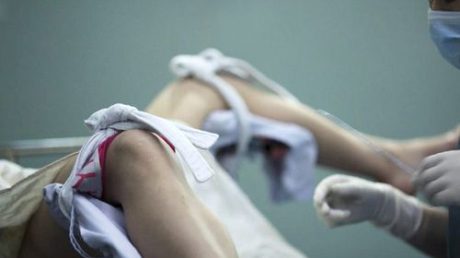 Для чего делают выскабливание матки при миоме?