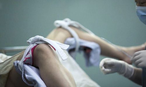 Для чего делают выскабливание матки при миоме?