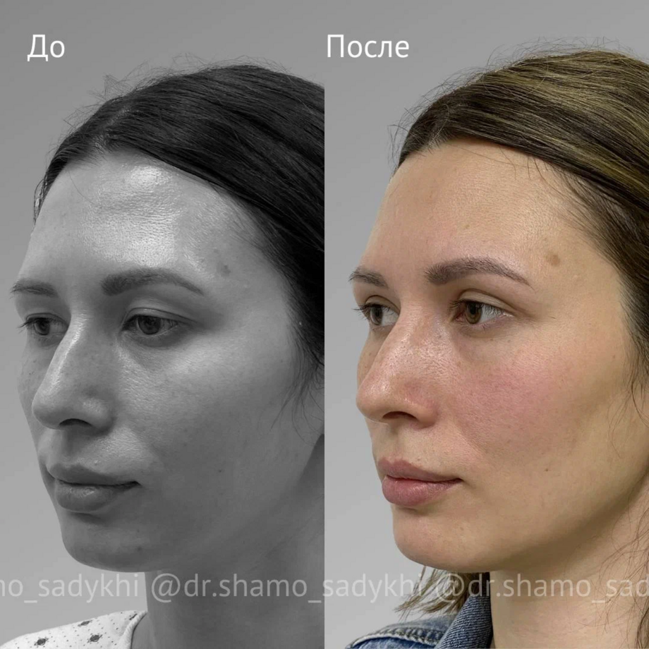 Эффект на лицо