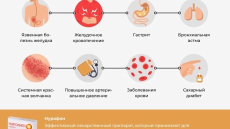 Эффективность Нурофена при цистите