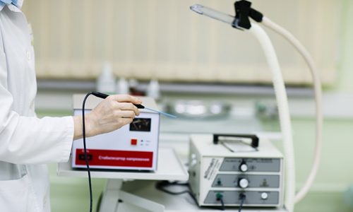 Эффективность радиоволнового метода удаления папиллом